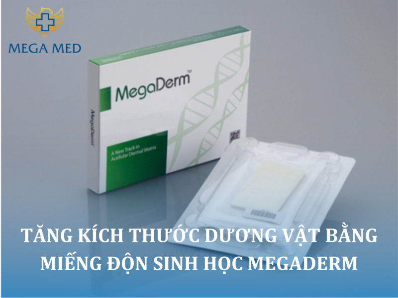 miếng độn mergadem